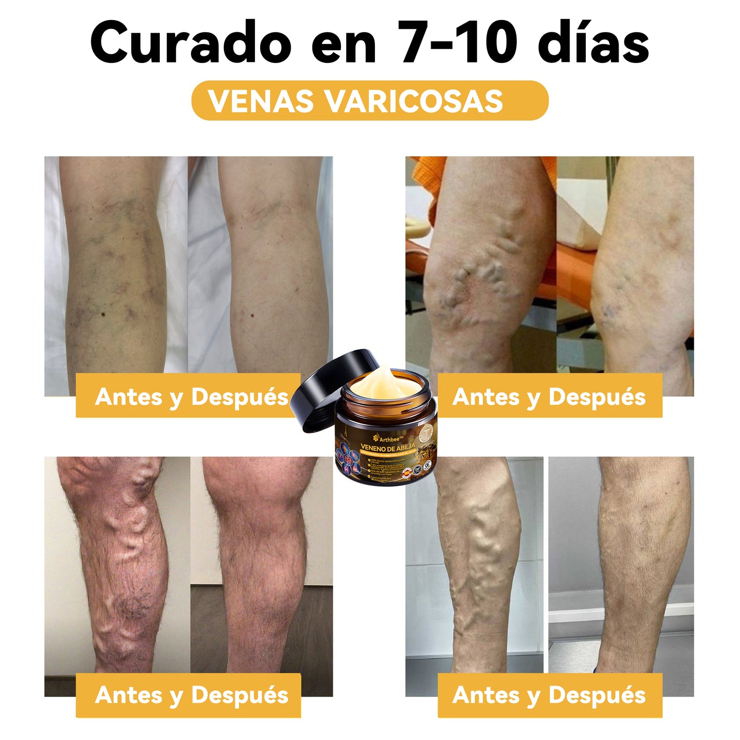 🦵Arthbee™ Terapias Crema con Veneno de Abeja para la Artritis (Especialmente para personas mayores, con la recomendación de la AAOS) 🔥El último día de la promoción con un 70% de descuento