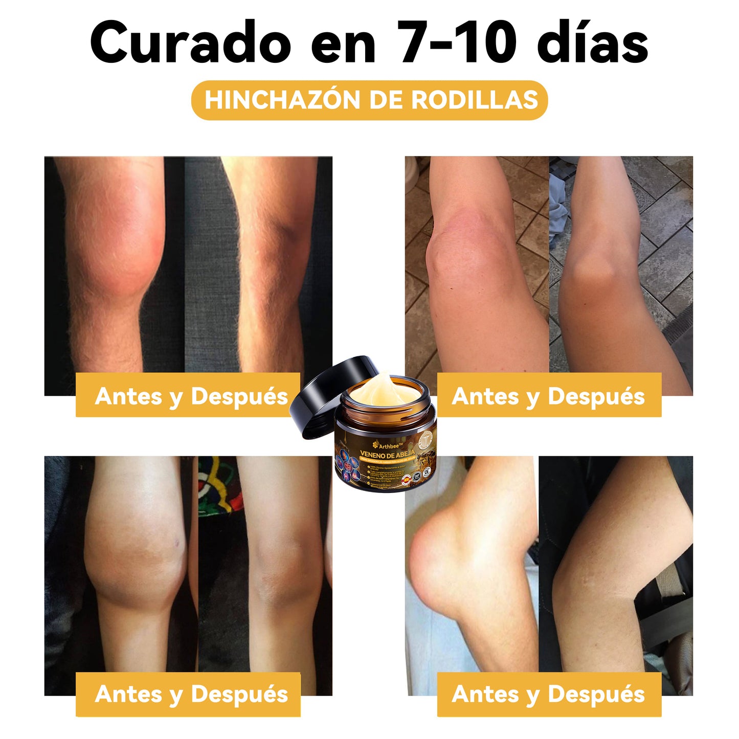 🦵Arthbee™ Terapias Crema con Veneno de Abeja para la Artritis (Especialmente para personas mayores, con la recomendación de la AAOS) 🔥El último día de la promoción con un 70% de descuento