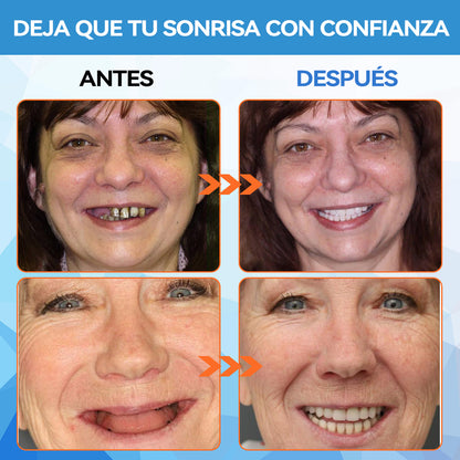 𝐁𝐢𝐤𝐞𝐧𝐝𝐚™💡 Juego de prótesis dentales de silicona reconstituible (🦷Descuento por tiempo limitado. Últimos 30 minutos🦷)