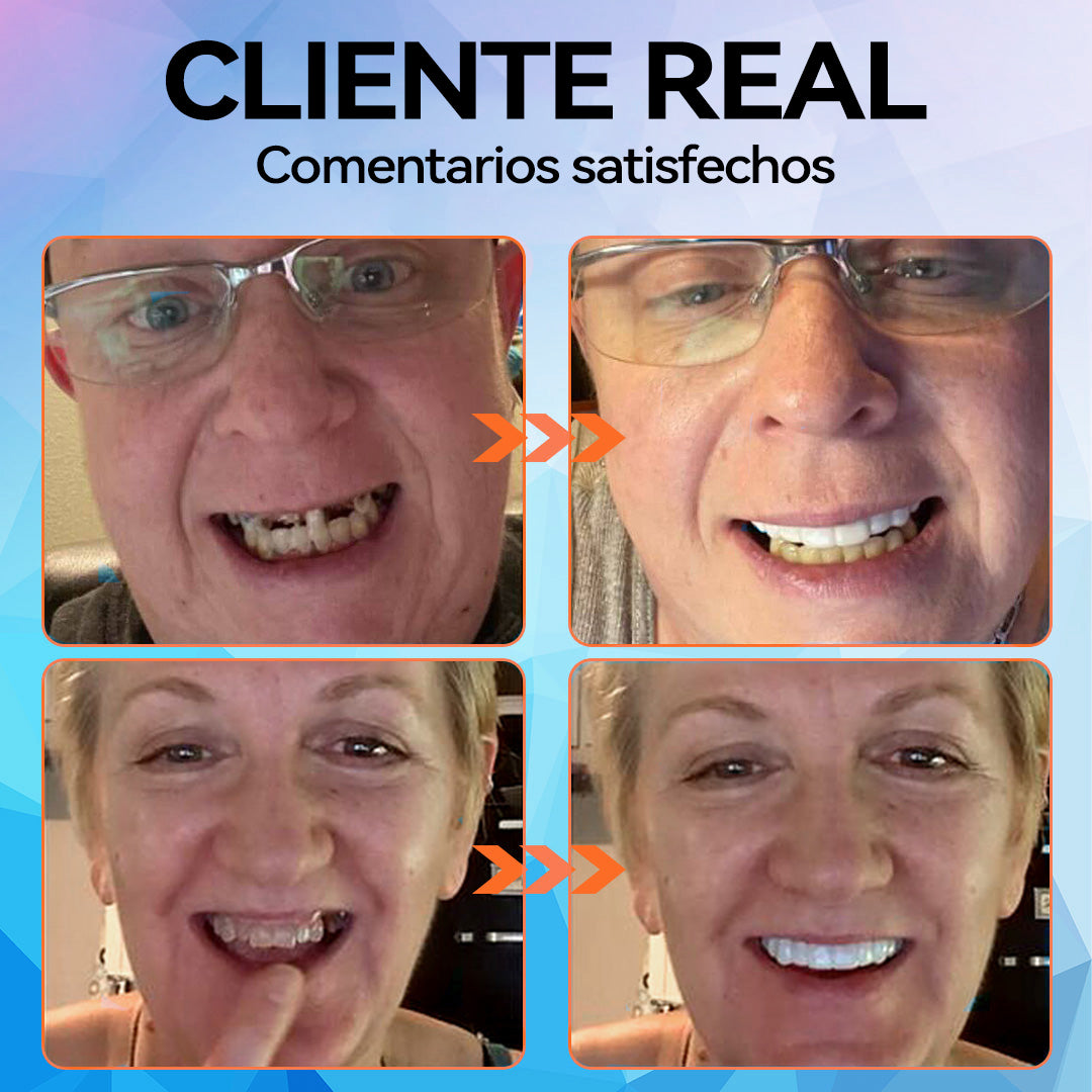 𝐁𝐢𝐤𝐞𝐧𝐝𝐚™💡 Juego de prótesis dentales de silicona reconstituible (🦷Descuento por tiempo limitado. Últimos 30 minutos🦷)