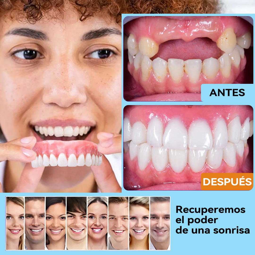 𝐁𝐢𝐤𝐞𝐧𝐝𝐚™💡 Juego de prótesis dentales de silicona reconstituible (🦷Descuento por tiempo limitado. Últimos 30 minutos🦷)